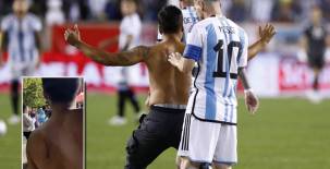 Viral: así quedó la firma de Messi en la espalda del aficionado que invadió el campo en el Argentina-Jamaica