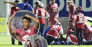 ¡Terrible lesión! Romario, jugador de Motagua, se rompe en dos el tobillo