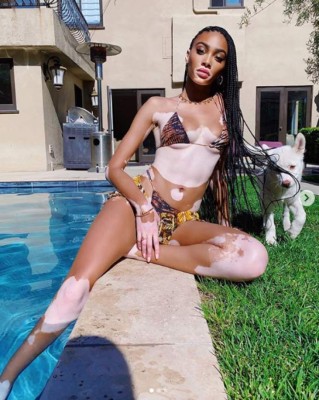 Winnie Harlow, preciosa modelo que padece de vitiligo, es 'cazada' con famoso deportista