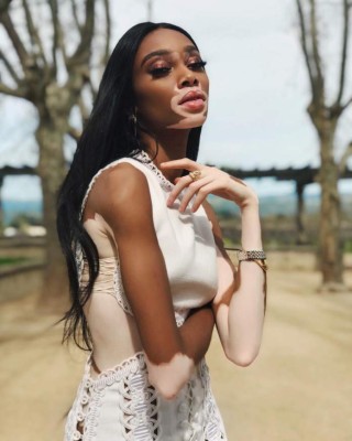Winnie Harlow, preciosa modelo que padece de vitiligo, es 'cazada' con famoso deportista