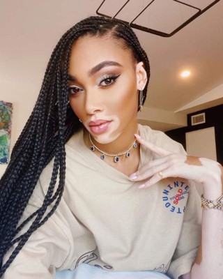 Winnie Harlow, preciosa modelo que padece de vitiligo, es 'cazada' con famoso deportista
