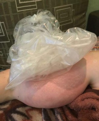 El rotundo cambio del 'Popeye' ruso: se sometió a una cirugía para salvar su vida