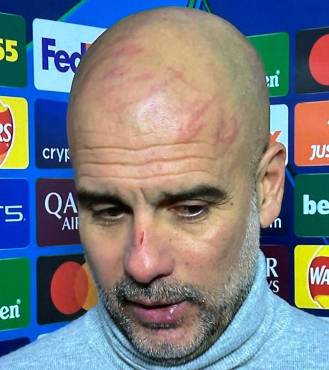 Pep Guardiola revela qué le pasó en la cara tras el Manchester City vs Feyenoord por la Champions League