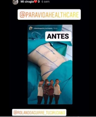 El antes y el después de la guapa Alejandra Rubio tras las cirugías plásticas