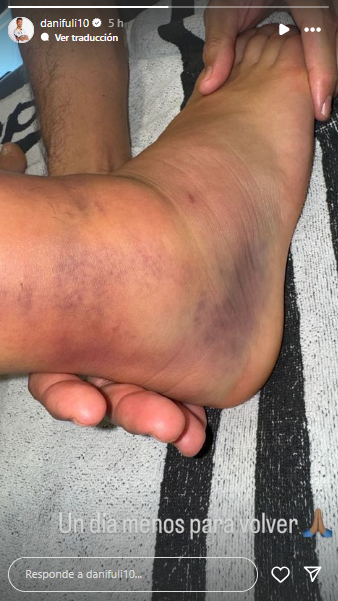 Así tiene Dani Ceballos su tobillo del pie derecho tras el duelo frente al Betis.