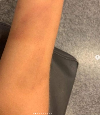 Sebastián Villa, futbolista de Boca Juniors, propinó brutal paliza a su esposa y esta lo denunció