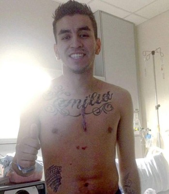 Escalofriantes: Las cicatrices más impactantes que han sufrido futbolistas y otros deportistas