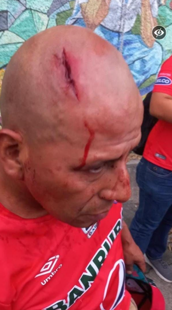 Fotos: Zafarrancho, gas lacrimógeno y los hondureños que fueron capturados por los fuertes disturbios entre barras de Municipal y Olimpia