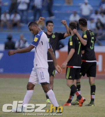 Las caras de sufrimiento y decepción de Honduras en el Olímpico