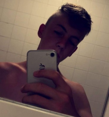 Cara desfigurada y huesos rotos: La paliza que le dieron a un soldado tras ser secuestrado en una cita de Tinder