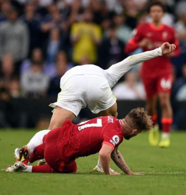 No apto para sensibles: Así fue la escalofriante lesión de Harvey Elliott del Liverpool; sufrimiento y shock de Klopp&nbsp;&nbsp;