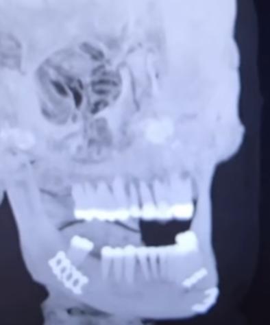 Anthony Joshua noqueó a Jake Paul con brutal derechazo y le rompe la mandíbula: Denme al Canelo...