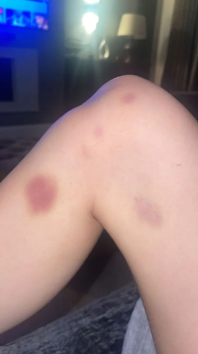 Escándalo en la Premier League: influencer filtra imágenes de la violencia que sufre por parte de jugador del Manchester United