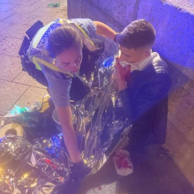 Impactantes imágenes: Ataque brutal a atleta olímpico gay que fue sometido a reconstrucción facial