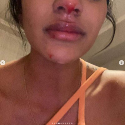 Sebastián Villa, futbolista de Boca Juniors, propinó brutal paliza a su esposa y esta lo denunció