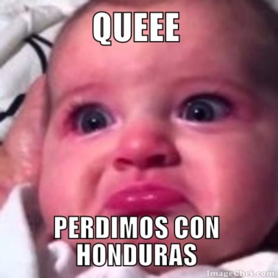 Los memes que dejó el Honduras-Canadá ¡Medford y Elis, los protagonistas!