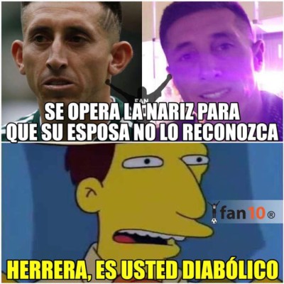 La cruel ola de memes por el cambio de rostro de Héctor Herrera tras sus cirugías estéticas