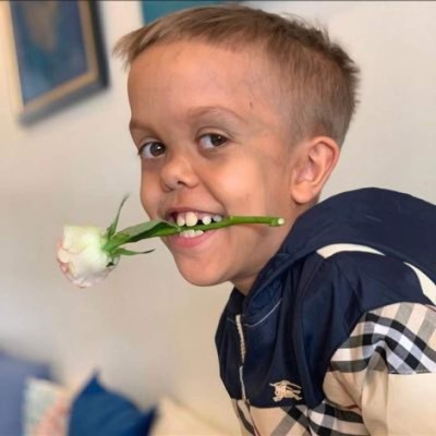 ¿Quién es Quaden Bayles, el niño que sufrió bullying y le pidió a su madre que le quitara la vida?