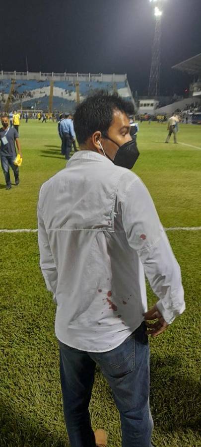 Las fotos del drama en el Morazán: Jhow Benavídez pidiendo calma, policía y aficionados heridos en el Clásico Real España-Marathón