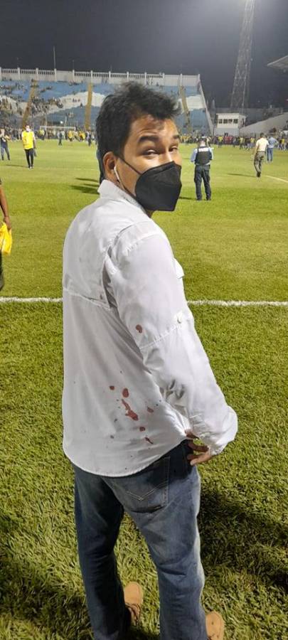 Las fotos del drama en el Morazán: Jhow Benavídez pidiendo calma, policía y aficionados heridos en el Clásico Real España-Marathón