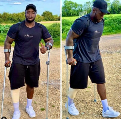 El calvario que vive Adebayo Akinfenwa, el futbolista de más de 220 libras: 'Me está matando'