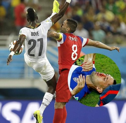 FOTOS: Las mejores 'barridas al pecho' del fútbol