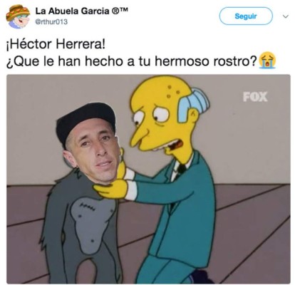 La cruel ola de memes por el cambio de rostro de Héctor Herrera tras sus cirugías estéticas