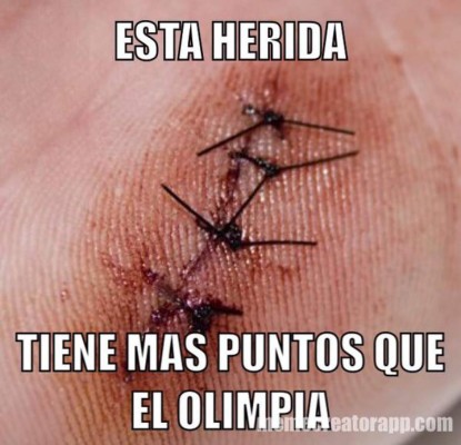 Los mejores memes que deja la jornada 3 en Honduras