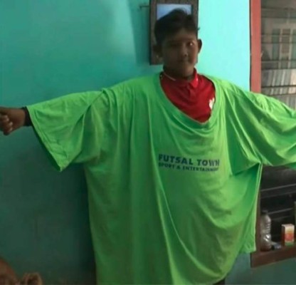 Impresionante: El tremendo cambio físico del niño más obeso del mundo que desea ser futbolista&nbsp;&nbsp;