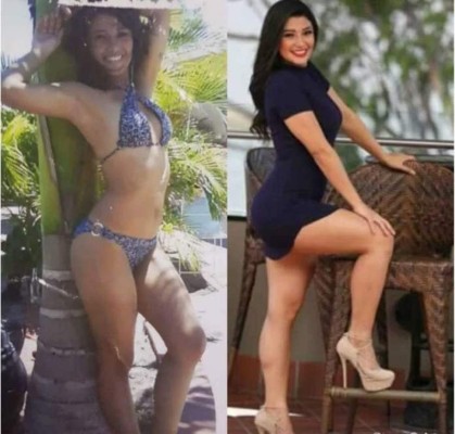 Las grandes transformaciones físicas de famosos, políticos y deportistas hondureños