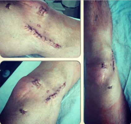 Las espeluznantes y temibles operaciones a los futbolistas