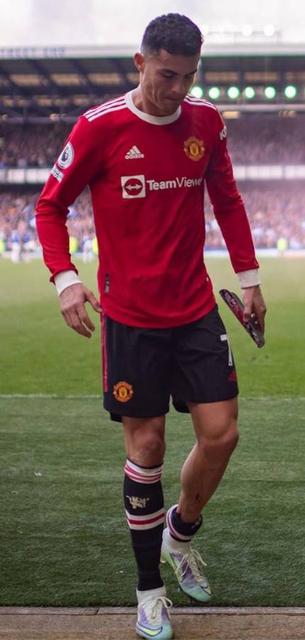 Escalofriante: así le quedó la pierna a Cristiano Ronaldo en la dolorosa derrota del Manchester United