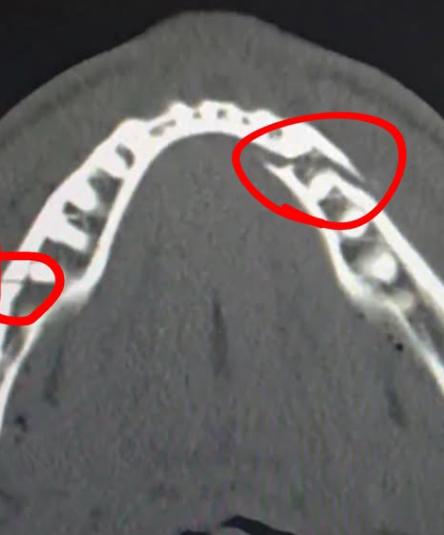 Anthony Joshua noqueó a Jake Paul con brutal derechazo y le rompe la mandíbula: Denme al Canelo...