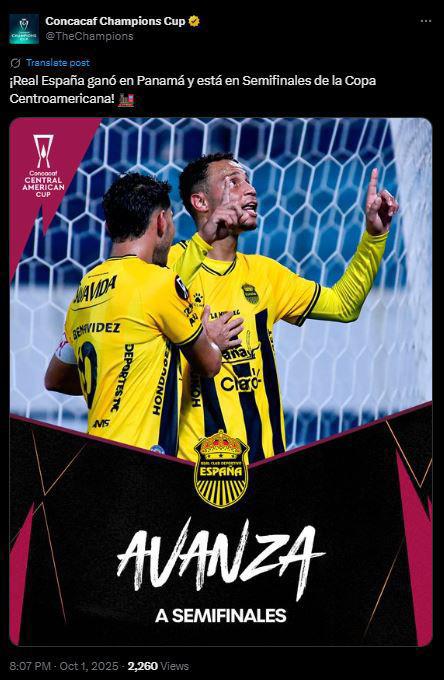 Hijos en todos lados, Son pequeños: Chepebomba reacciona y la prensa exalta la clasificación del Real España