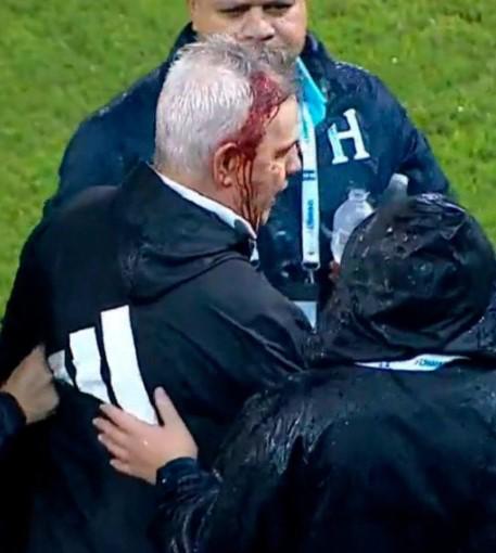 Bronca entre jugadores, el festejo de Honduras tras vencer a México y el feo gesto de Javier Aguirre, quien sufrió un corte en la cabeza
