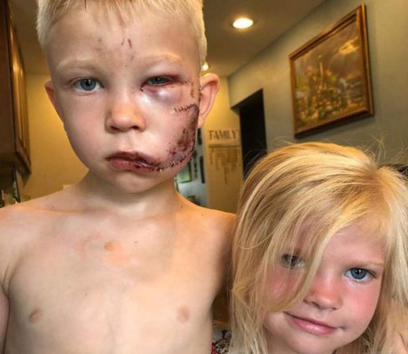 Arriesgó su vida para salvar a su hermana del brutal ataque de un perro y ahora fue reconocido por el Consejo Mundial del Boxeo