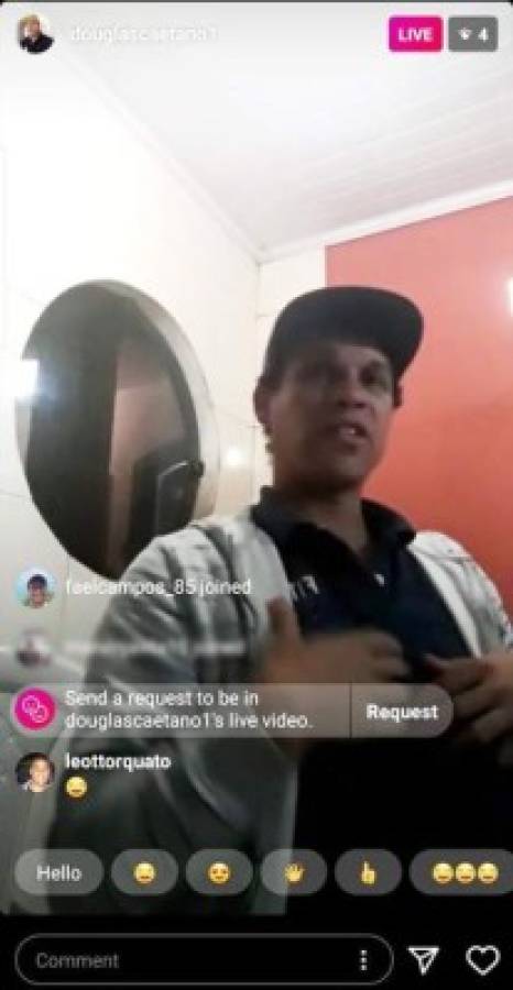 Douglas Caetano aparece en un Live de Instagram y sorprende con su maltratada apariencia