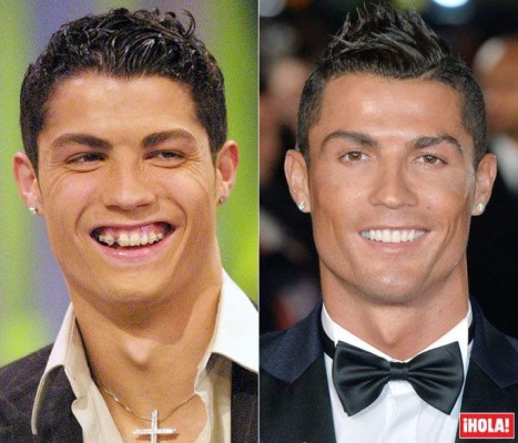 10 Year Challenge: Los despiadados memes del reto viral en las redes sociales