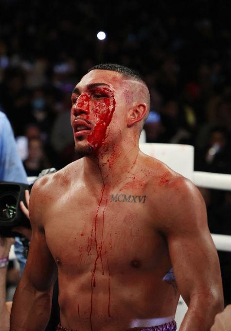 Las impactantes imágenes del rostro de Teófimo López y el derechazo que lo mandó al suelo