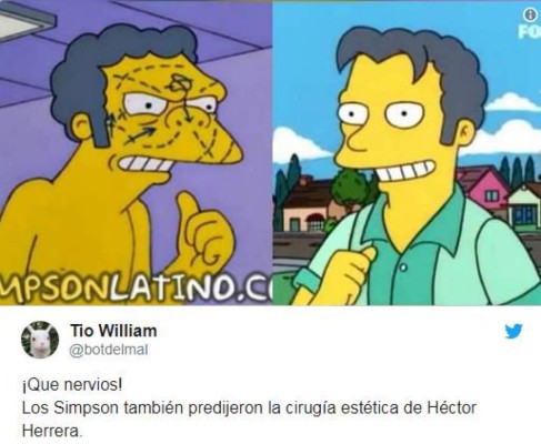 La cruel ola de memes por el cambio de rostro de Héctor Herrera tras sus cirugías estéticas