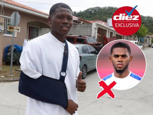 Jaylor Fernández se fracturó la clavícula y eso le hace perderse el resto de torneo.