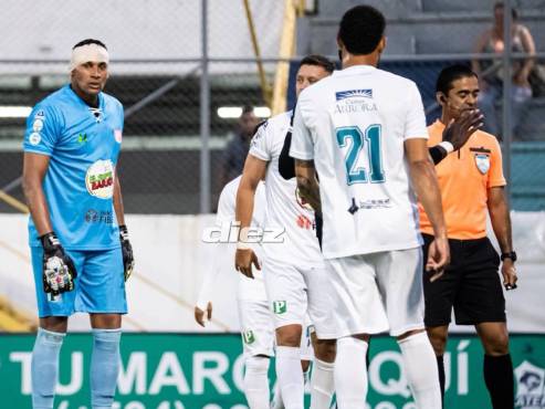 Sandro Cárcamo se estrelló con el poste y tuvo que ser vendado por el cuerpo médico de los 'Escualos'.