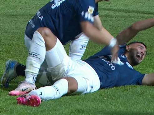 Así le quedó el tobillo a Victorio Ramses, futbolista argentino.