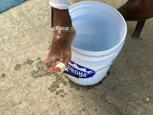 Foto exclusiva de la lesión de Clayvin Zúniga que podría perderse la semifinal de vuelta.