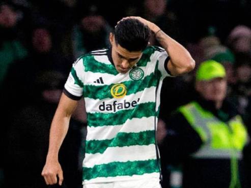El Celtic de Luis Palma sumó su segunda derrota al hilo en la primera división de Escocia.
