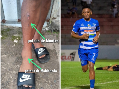 Los golpes que ha recibido Alexy Vega en los primeras tres jornadas del torneo Clausura 2023 de la Liga Nacional.