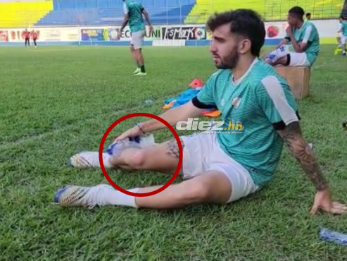 Agustín Auzmendi sufrió un golpe en la semifinal de vuelta entre Olancho-Real España.