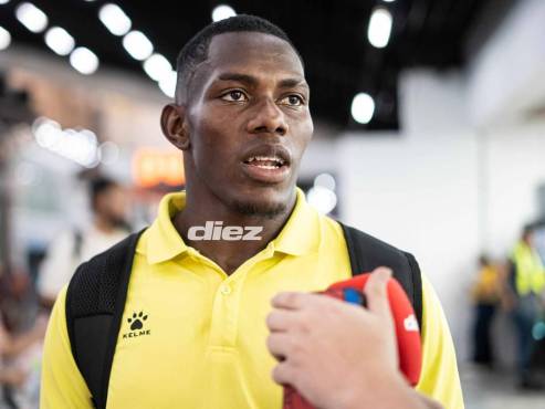 Dixon revela que ya no viaja en taxi, palpita el partido ante Herediano y deja mensaje a la afición: No nos dejen solos