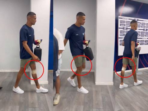 Así salió el mediocampista Kervin Arriaga tras jugar ante Real Madrid.