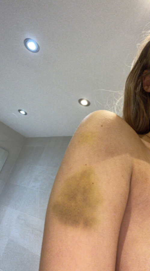 Escándalo en la Premier League: influencer filtra imágenes de la violencia que sufre por parte de jugador del Manchester United